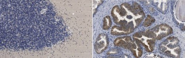 Anti-GABARAPL2 from rabbit, purified by affinity chromatography