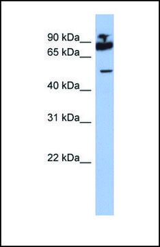 Anti-IKZF1 antibody produced in rabbit affinity isolated antibody