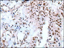 Anti-XAB2 affinity isolated antibody