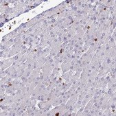 Anti-APOBR antibody produced in rabbit Prestige Antibodies® Powered by Atlas Antibodies, affinity isolated antibody, buffered aqueous glycerol solution