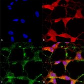 Monoclonal Anti-TRPV3 antibody produced in mouse clone S59-20, 1 mg/mL, purified immunoglobulin