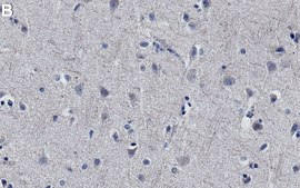 Anti-DCLK1-S Antibody, clone 1D13 ZooMAb® Rabbit Monoclonal recombinant, expressed in HEK 293 cells