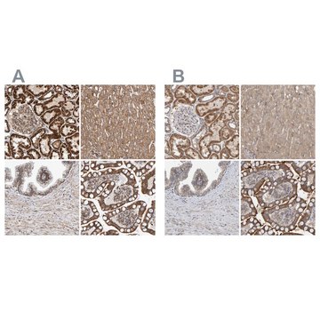 Anti-MRPL45 antibody produced in rabbit Prestige Antibodies&#174; Powered by Atlas Antibodies, affinity isolated antibody, buffered aqueous glycerol solution, Ab1