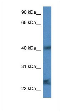 Anti-SCAMP1 antibody produced in rabbit affinity isolated antibody