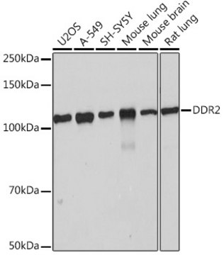 Anti-DDR2 Antibody, clone 1M8U7, Rabbit Monoclonal