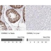 Anti-CARMIL1 antibody produced in rabbit Prestige Antibodies® Powered by Atlas Antibodies, affinity isolated antibody, buffered aqueous glycerol solution, ab1