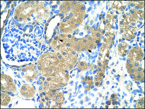 Anti-TNNI1 (AB1) antibody produced in rabbit affinity isolated antibody