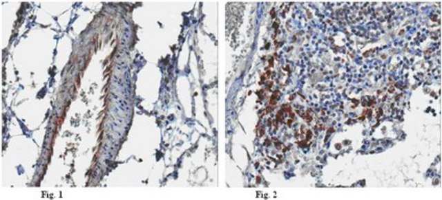 Anti-Endostatin Antibody from rabbit, purified by affinity chromatography