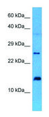 Anti-RPS27A antibody produced in rabbit affinity isolated antibody