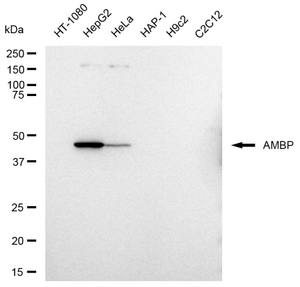 KD-Validated Anti AMBP Antibody, clone 23GB3200, Rabbit Monoclonal clone 23GB3200, recombinant rabbit monoclonal, expressed in HEK293 cells