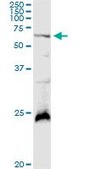 Anti-GALNT4 antibody produced in rabbit purified immunoglobulin, buffered aqueous solution