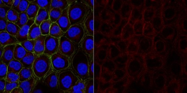 Anti-Cytokeratin 5,6 Antibody, clone D5/16B4, Alexa Fluor&#8482; 647 clone D5/16B4, from mouse, ALEXA FLUOR&#8482; 647