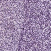 Anti-RS1 antibody produced in rabbit Prestige Antibodies® Powered by Atlas Antibodies, affinity isolated antibody