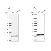 Anti-RPS15 antibody produced in rabbit Prestige Antibodies® Powered by Atlas Antibodies, affinity isolated antibody, buffered aqueous glycerol solution