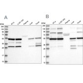Anti-PDHX antibody produced in rabbit Prestige Antibodies® Powered by Atlas Antibodies, affinity isolated antibody, buffered aqueous glycerol solution