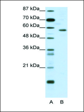 Anti-YY1 (AB1) antibody produced in rabbit affinity isolated antibody