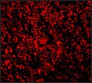 Anti-ARMER antibody produced in rabbit affinity isolated antibody, buffered aqueous solution