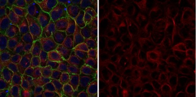 Anti-&#945;-Tubulin Antibody, clone DM1A, Alexa Fluor&#8482; 555 Conjugate clone DM1A, from mouse, ALEXA FLUOR&#8482; 555