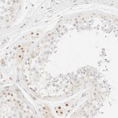 Anti-TSR1 antibody produced in rabbit Prestige Antibodies® Powered by Atlas Antibodies, affinity isolated antibody, buffered aqueous glycerol solution