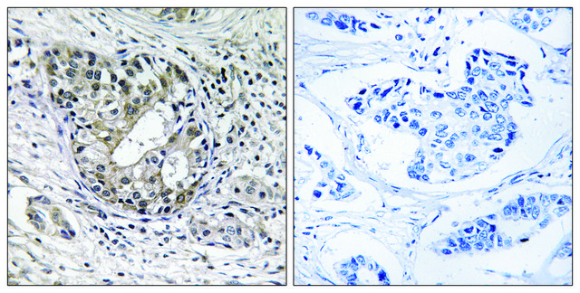 Anti-PNPT1 antibody produced in rabbit affinity isolated antibody