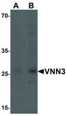 Anti-VNN3 antibody produced in rabbit affinity isolated antibody