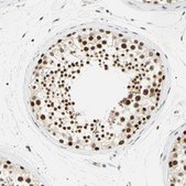 Anti-SMARCA5 antibody produced in rabbit Prestige Antibodies® Powered by Atlas Antibodies, affinity isolated antibody, buffered aqueous glycerol solution