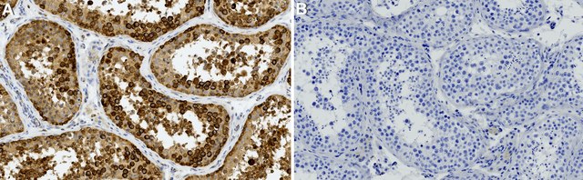 Anti-YB1 Antibody, clone 1G7 ZooMAb&#174; Rabbit Monoclonal recombinant, expressed in HEK 293 cells