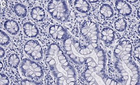 Anti-OAS1 Antibody, clone 1N2 ZooMAb® Rabbit Monoclonal recombinant, expressed in HEK 293 cells