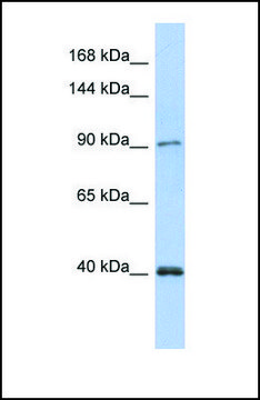 Anti-POLK antibody produced in rabbit affinity isolated antibody