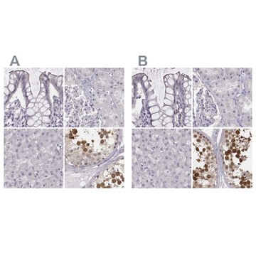 Anti-PBK antibody produced in rabbit affinity isolated antibody, buffered aqueous glycerol solution