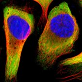 Anti-RPL14 antibody produced in rabbit Prestige Antibodies® Powered by Atlas Antibodies, affinity isolated antibody, buffered aqueous glycerol solution