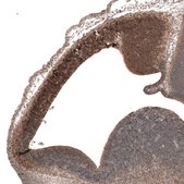 Anti-EMX1 antibody produced in rabbit Prestige Antibodies® Powered by Atlas Antibodies, affinity isolated antibody, buffered aqueous glycerol solution