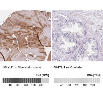 Anti-SMYD1 antibody produced in rabbit Prestige Antibodies&#174; Powered by Atlas Antibodies, affinity isolated antibody, buffered aqueous glycerol solution