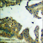 Anti-phospho-KIF20A (pSer528) antibody produced in rabbit affinity isolated antibody