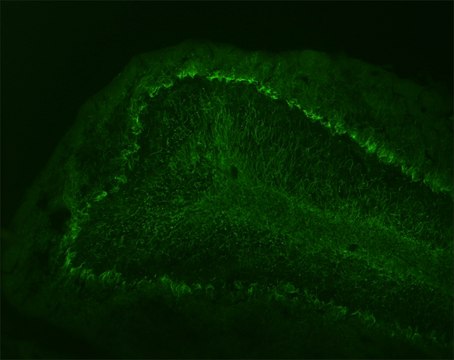 Monoclonal Anti-Neurofilament 68 antibody produced in mouse clone NR4, ascites fluid