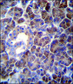 ANTI-PTDSS2 (N-TERM) antibody produced in rabbit IgG fraction of antiserum, buffered aqueous solution