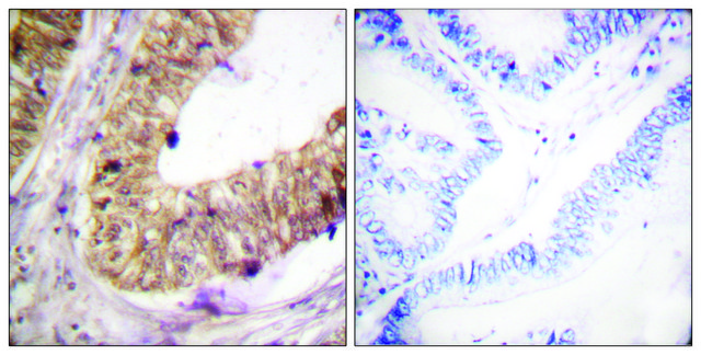 Anti-ATRIP antibody produced in rabbit affinity isolated antibody