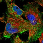 Anti-FAM47E antibody produced in rabbit Prestige Antibodies® Powered by Atlas Antibodies, affinity isolated antibody, buffered aqueous glycerol solution
