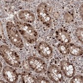 Anti-KIF20A antibody produced in rabbit Prestige Antibodies® Powered by Atlas Antibodies, affinity isolated antibody, buffered aqueous glycerol solution