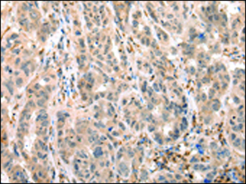 Anti-EPHB4 affinity isolated antibody