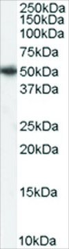 Anti-PICK1 antibody produced in goat affinity isolated antibody, buffered aqueous solution