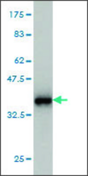 Monoclonal Anti-S100A8 antibody produced in mouse clone 2H2, purified immunoglobulin, buffered aqueous solution