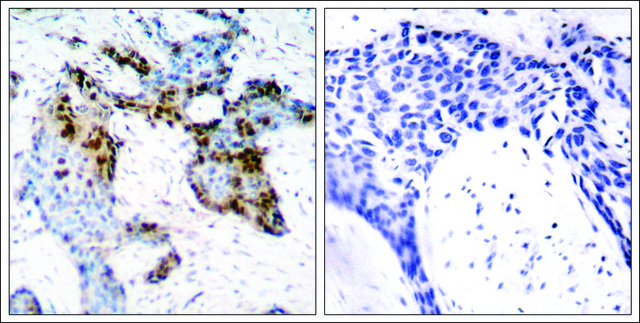 Anti-ESR1 (Ab-118) antibody produced in rabbit affinity isolated antibody