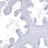Monoclonal Anti-LHX9 antibody produced in mouse Prestige Antibodies® Powered by Atlas Antibodies, clone CL15043, purified antibody (Protein A)