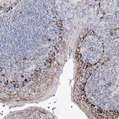 Anti-NRROS antibody produced in rabbit Prestige Antibodies® Powered by Atlas Antibodies, affinity isolated antibody, buffered aqueous glycerol solution