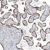 Anti-CXorf21 antibody produced in rabbit affinity isolated antibody, buffered aqueous glycerol solution