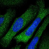 Anti-TARS antibody produced in rabbit Prestige Antibodies® Powered by Atlas Antibodies, affinity isolated antibody, buffered aqueous glycerol solution