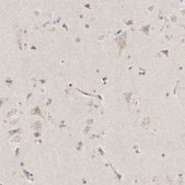 Anti-SLC25A26 antibody produced in rabbit Prestige Antibodies® Powered by Atlas Antibodies, affinity isolated antibody, buffered aqueous glycerol solution