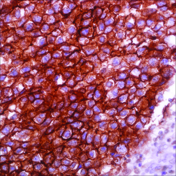 Podoplanin (D2-40) Mouse Monoclonal Antibody