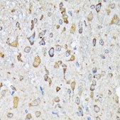 Anti-LysRS/KARS antibody produced in rabbit